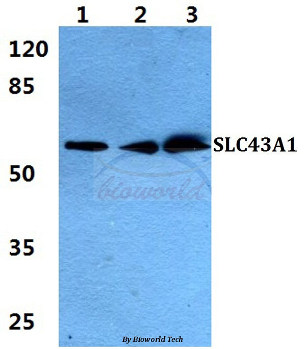 Western blot (WB) analysis of SLC43A1 polyclonal antibody at 1:500 dilution
Lane1:HEK293T cell lysate
Lane2:sp2/0 cell lysate
Lane3:H9C2 cell lysate