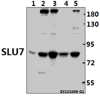 Western blot (WB) analysis of SLU7 (F144) pAb at 1:1000 dilution
Lane1:PC12 whole cell lysate(40ug)
Lane2:AML-12 whole cell lysate(40ug)
Lane3:HEK293T whole cell lysate(40ug)
Lane4:SGC7901 whole cell lysate(40ug)
Lane5:L02 whole cell lysate(40ug)