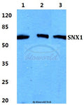 Western blot (WB) analysis of SNX1 polyclonal antibody at 1:500 dilution
Lane1:HEK293T cell lysate
Lane2:sp2/0 cell lysate
Lane3:H9C2 cell lysate