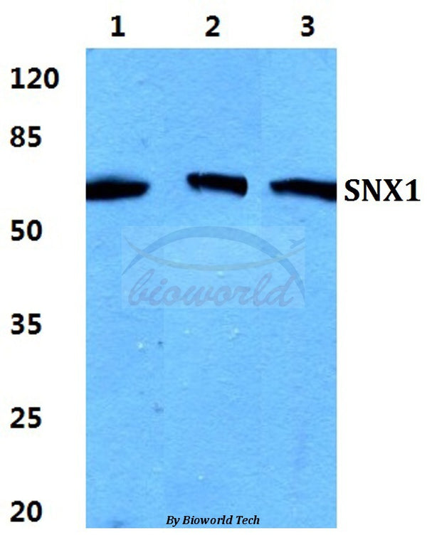 Western blot (WB) analysis of SNX1 polyclonal antibody at 1:500 dilution
Lane1:HEK293T cell lysate
Lane2:sp2/0 cell lysate
Lane3:H9C2 cell lysate