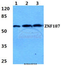 Western blot (WB) analysis of ZNF187 polyclonal antibody at 1:500 dilution
Lane1:HEK293T cell lysate
Lane2:Hela cell lysate
Lane3:sp2/0 cell lysate