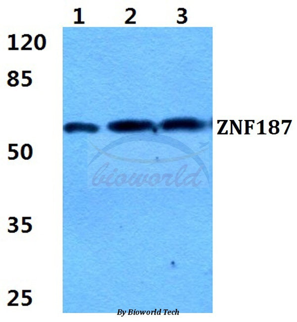 Western blot (WB) analysis of ZNF187 polyclonal antibody at 1:500 dilution
Lane1:HEK293T cell lysate
Lane2:Hela cell lysate
Lane3:sp2/0 cell lysate