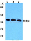 Western blot (WB) analysis of SSBP2 polyclonal antibody at 1:500 dilution
Lane1:HEK293T cell lysate
Lane2:NIH-3T3 cell lysate
Lane3:Rat kidney tissue lysate