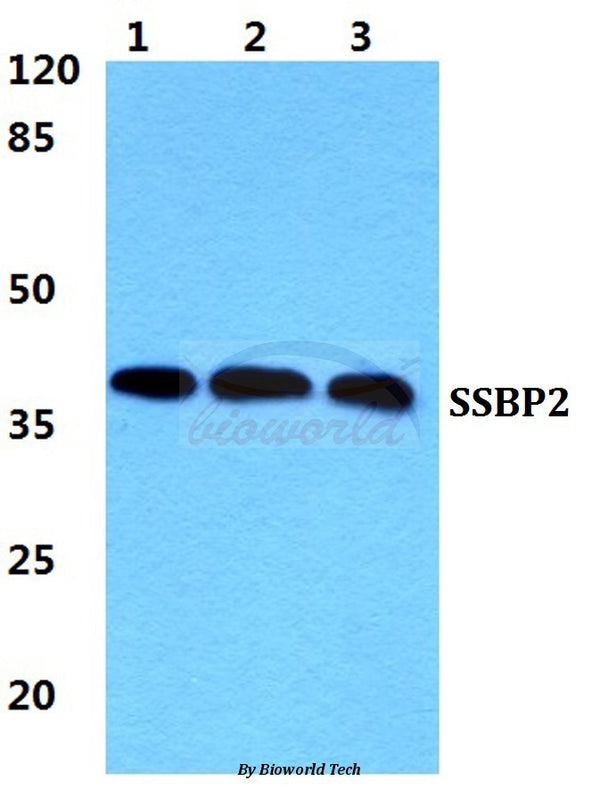 Western blot (WB) analysis of SSBP2 polyclonal antibody at 1:500 dilution
Lane1:HEK293T cell lysate
Lane2:NIH-3T3 cell lysate
Lane3:Rat kidney tissue lysate