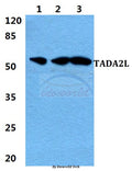 Western blot (WB) analysis of TADA2L polyclonal antibody at 1:500 dilution
Lane1:MCF-7 cell lysate
Lane2:sp2/0 cell lysate
Lane3:H9C2 cell lysate
