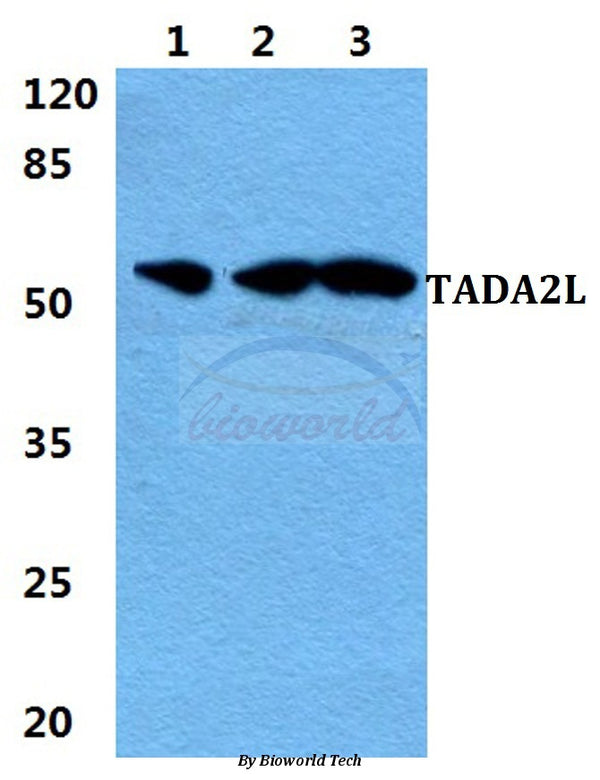 Western blot (WB) analysis of TADA2L polyclonal antibody at 1:500 dilution
Lane1:MCF-7 cell lysate
Lane2:sp2/0 cell lysate
Lane3:H9C2 cell lysate
