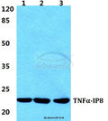 Western blot (WB) analysis of TNFα-IP8 polyclonal antibody at 1:500 dilution
Lane1:HEK293T cell lysate
Lane2:Raw264.7 cell lysate
Lane3:H9C2 cell lysate