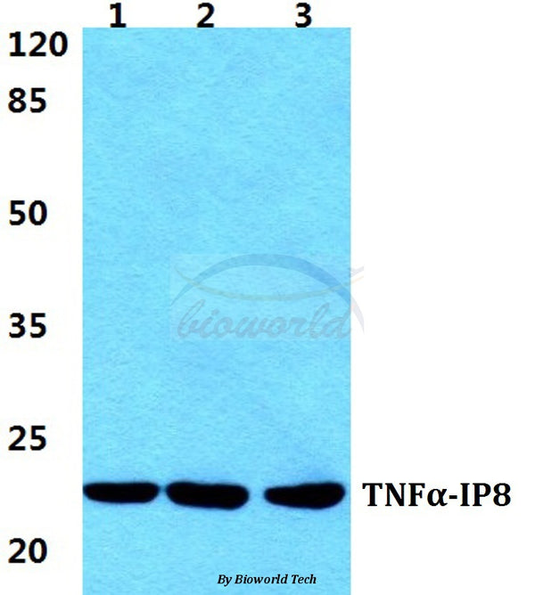 Western blot (WB) analysis of TNFα-IP8 polyclonal antibody at 1:500 dilution
Lane1:HEK293T cell lysate
Lane2:Raw264.7 cell lysate
Lane3:H9C2 cell lysate