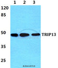 Western blot (WB) analysis of TRIP13 polyclonal antibody at 1:500 dilution
Lane1:Hela cell lysate
Lane2:NIH-3T3 cell lysate
Lane3:PC12 cell lysate