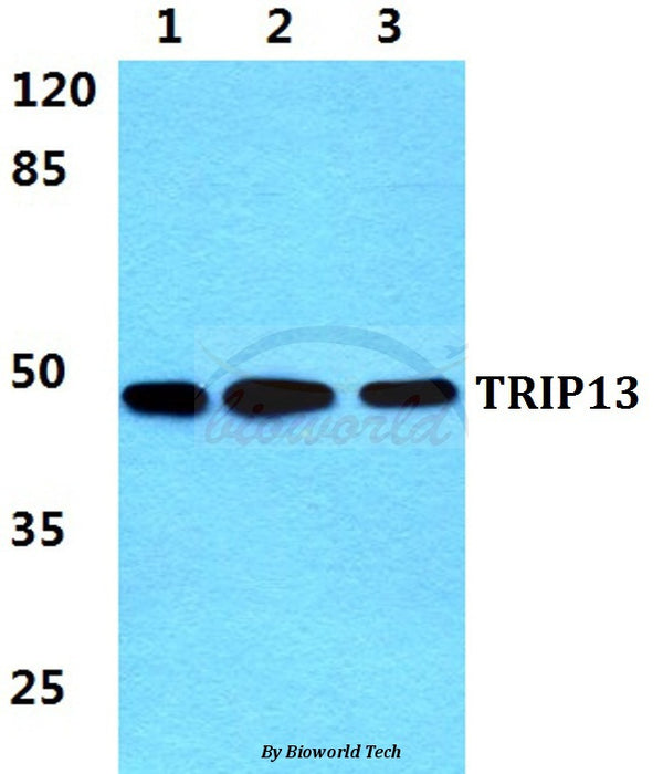 Western blot (WB) analysis of TRIP13 polyclonal antibody at 1:500 dilution
Lane1:Hela cell lysate
Lane2:NIH-3T3 cell lysate
Lane3:PC12 cell lysate