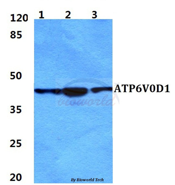 Western blot (WB) analysis of ATP6V0D1 polyclonal antibody at 1:500 dilution
Lane1:HEK293T cell lysate
Lane2:sp2/0 cell lysate
Lane3:H9C2 cell lysate