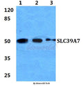 Western blot (WB) analysis of SLC39A7 polyclonal antibody at 1:500 dilution
Lane1:Hela cell lysate
Lane2:sp2/0 cell lysate
Lane3:H9C2 cell lysate