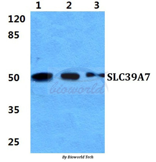 Western blot (WB) analysis of SLC39A7 polyclonal antibody at 1:500 dilution
Lane1:Hela cell lysate
Lane2:sp2/0 cell lysate
Lane3:H9C2 cell lysate
