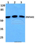 Western blot (WB) analysis of ZNF682 polyclonal antibody at 1:500 dilution
Lane1:HEK293T cell lysate
Lane2:NIH-3T3 cell lysate
Lane3:H9C2 cell lysate