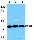Western blot (WB) analysis of ZADH1 polyclonal antibody at 1:500 dilution
Lane1:Hela cell lysate
Lane2:sp2/0 cell lysate
Lane3:PC12 cell lysate