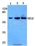 Western blot (WB) analysis of E-Selectin polyclonal antibody at 1:500 dilution
Lane1:Jurkat whole cell lysate
Lane2:NIH-3T3 whole cell lysate
Lane3:PC12 whole cell lysate