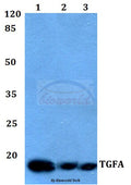 TGFα polyclonal antibody - Figure 1 of 1