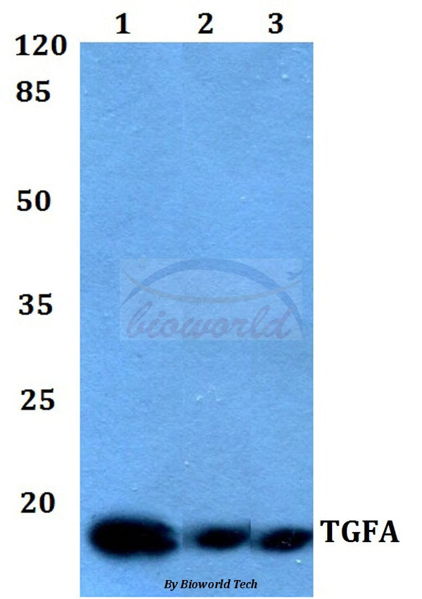 TGFα polyclonal antibody - Figure 1 of 1