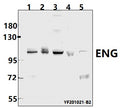 Western blot (WB) analysis of ENG pAb at 1:500 dilution
Lane1:PC3 whole cell lysate(40ug)
Lane2:HEK293T whole cell lysate(40ug)
Lane3:Hela whole cell lysate(40ug)
Lane4:PC12 whole cell lysate(40ug)
Lane5:3T3-L1 whole cell lysate(40ug)