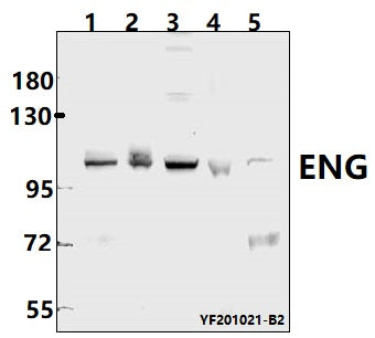 Western blot (WB) analysis of ENG pAb at 1:500 dilution
Lane1:PC3 whole cell lysate(40ug)
Lane2:HEK293T whole cell lysate(40ug)
Lane3:Hela whole cell lysate(40ug)
Lane4:PC12 whole cell lysate(40ug)
Lane5:3T3-L1 whole cell lysate(40ug)