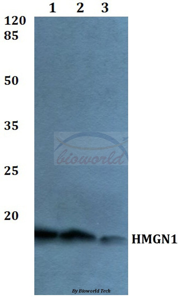 Western blot (WB) analysis of HMGN1 polyclonal antibody at 1:500 dilution
Lane1:Hela whole cell lysate
Lane2:NIH-3T3 whole cell lysate
Lane3:H9C2 whole cell lysate