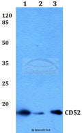 Western blot (WB) analysis of CD52 polyclonal antibody at 1:500 dilution
Lane1:THP-1 whole cell lysate
Lane2:Mouse spleen tissue lysate
Lane3:H9C2 whole cell lysate