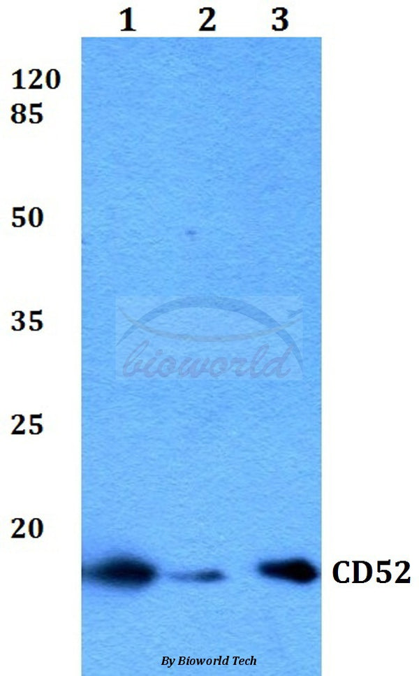 Western blot (WB) analysis of CD52 polyclonal antibody at 1:500 dilution
Lane1:THP-1 whole cell lysate
Lane2:Mouse spleen tissue lysate
Lane3:H9C2 whole cell lysate
