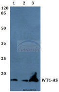 Western blot (WB) analysis of WT1-AS polyclonal antibody at 1:500 dilution
Lane1:A549 whole cell lysate
Lane2:Raw264.7 whole cell lysate
Lane3:H9C2 whole cell lysate
