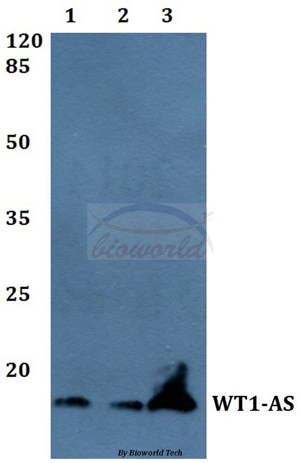 Western blot (WB) analysis of WT1-AS polyclonal antibody at 1:500 dilution
Lane1:A549 whole cell lysate
Lane2:Raw264.7 whole cell lysate
Lane3:H9C2 whole cell lysate