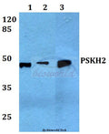 Western blot (WB) analysis of PSK-H2 polyclonal antibody at 1:500 dilution
Lane1:Hela whole cell lysate
Lane2:HEK293T whole cell lysate
Lane3:Mouse brain tissue lysate