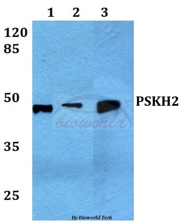 Western blot (WB) analysis of PSK-H2 polyclonal antibody at 1:500 dilution
Lane1:Hela whole cell lysate
Lane2:HEK293T whole cell lysate
Lane3:Mouse brain tissue lysate