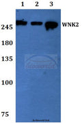 Western blot (WB) analysis of WNK2 polyclonal antibody at 1:500 dilution
Lane1:Hela whole cell lysate
Lane2:sp2/0 whole cell lysate
Lane3:MCF-7 whole cell lysate