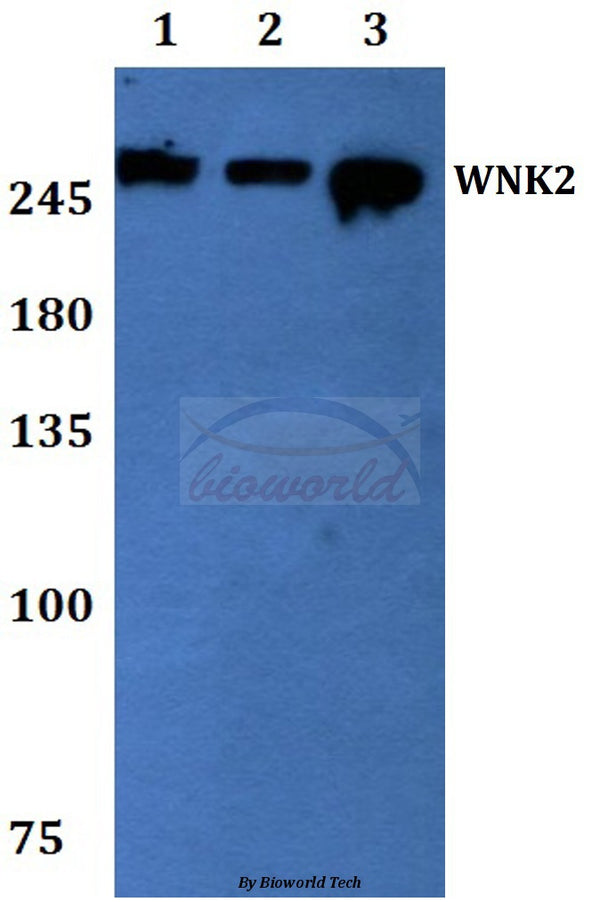 Western blot (WB) analysis of WNK2 polyclonal antibody at 1:500 dilution
Lane1:Hela whole cell lysate
Lane2:sp2/0 whole cell lysate
Lane3:MCF-7 whole cell lysate