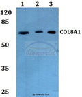 Western blot (WB) analysis of COL8A1 polyclonal antibody at 1:500 dilution
Lane1:A549 whole cell lysate
Lane2:sp2/0 whole cell lysate
Lane3:PC12 whole cell lysate
