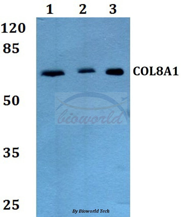 Western blot (WB) analysis of COL8A1 polyclonal antibody at 1:500 dilution
Lane1:A549 whole cell lysate
Lane2:sp2/0 whole cell lysate
Lane3:PC12 whole cell lysate