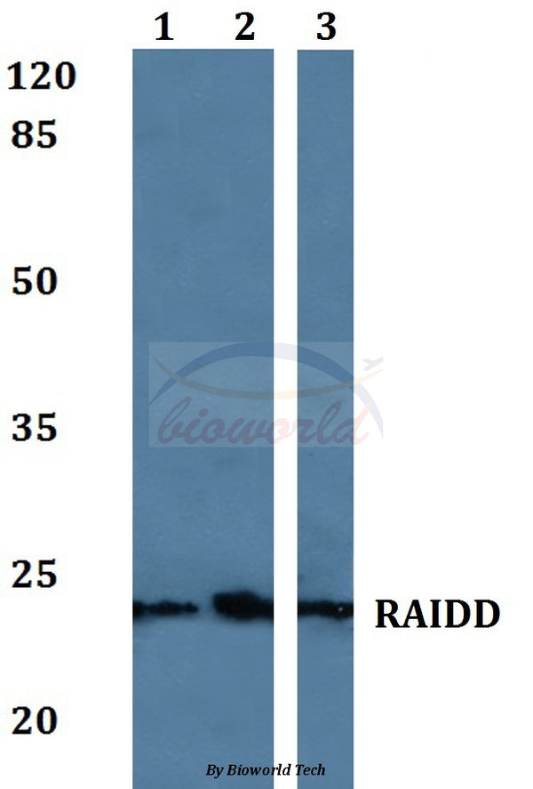 Western blot (WB) analysis of RAIDD polyclonal antibody at 1:500 dilution
Lane1:MCF-7 whole cell lysate
Lane2:sp2/0 whole cell lysate
Lane3:PC12 whole cell lysate