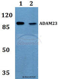 Western blot (WB) analysis of ADAM23 polyclonal antibody at 1:500 dilution
Lane1:MCF-7 whole cell lysate
Lane2:Raw264.7 whole cell lysate