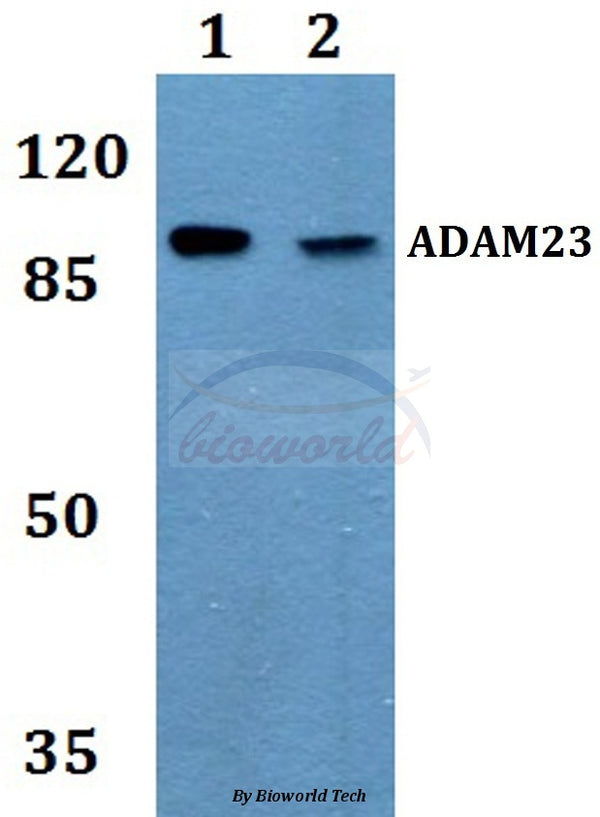 Western blot (WB) analysis of ADAM23 polyclonal antibody at 1:500 dilution
Lane1:MCF-7 whole cell lysate
Lane2:Raw264.7 whole cell lysate