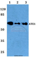 Western blot (WB) analysis of ATE1 polyclonal antibody at 1:500 dilution
Lane1:A549 whole cell lysate
Lane2:Raw264.7 whole cell lysate
Lane3:H9C2 whole cell lysate