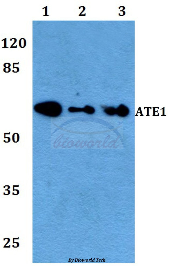 Western blot (WB) analysis of ATE1 polyclonal antibody at 1:500 dilution
Lane1:A549 whole cell lysate
Lane2:Raw264.7 whole cell lysate
Lane3:H9C2 whole cell lysate
