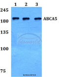 Western blot (WB) analysis of ABCA5 polyclonal antibody at 1:500 dilution
Lane1:HepG2 whole cell lysate
Lane2:NIH-3T3 whole cell lysate
Lane3:H9C2 whole cell lysate