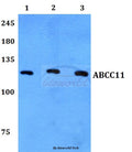 Western blot (WB) analysis of ABCC11 polyclonal antibody at 1:500 dilution
Lane1:HepG2 whole cell lysate
Lane2:Raw264.7 whole cell lysate
Lane3:H9C2 whole cell lysate