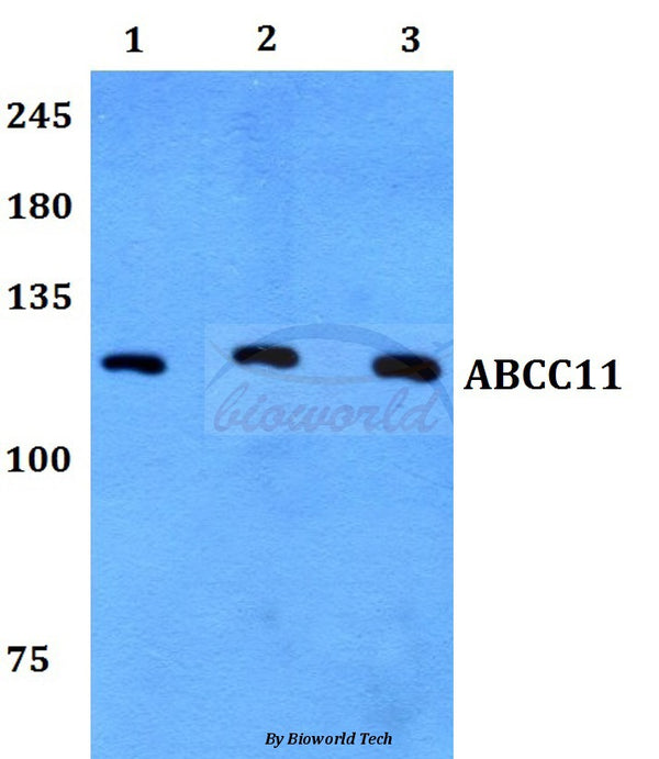 Western blot (WB) analysis of ABCC11 polyclonal antibody at 1:500 dilution
Lane1:HepG2 whole cell lysate
Lane2:Raw264.7 whole cell lysate
Lane3:H9C2 whole cell lysate
