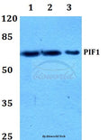 Western blot (WB) analysis of PIF1 polyclonal antibody at 1:500 dilution
Lane1:Hela whole cell lysate
Lane2:Raw264.7 whole cell lysate
Lane3:PC12 whole cell lysate