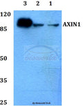 Western blot (WB) analysis of AXIN1 polyclonal antibody at 1:500 dilution
Lane1:HEK293T whole cell lysate
Lane2:NIH-3T3 whole cell lysate
Lane3:PC12 whole cell lysate