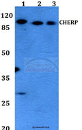 Western blot (WB) analysis of CHERP polyclonal antibody at 1:500 dilution
Lane1:THP-1 whole cell lysate
Lane2:Raw264.7 whole cell lysate
Lane3:H9C2 whole cell lysate