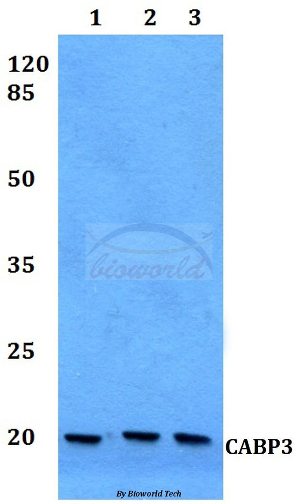 Western blot (WB) analysis of CABP3 polyclonal antibody at 1:500 dilution
Lane1:HEK293T whole cell lysate
Lane2:NIH-3T3 whole cell lysate
Lane3:H9C2 whole cell lysate