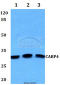 Western blot (WB) analysis of CABP4 polyclonal antibody at 1:500 dilution
Lane1:Hela whole cell lysate
Lane2:sp2/0 whole cell lysate
Lane3:PC12 whole cell lysate