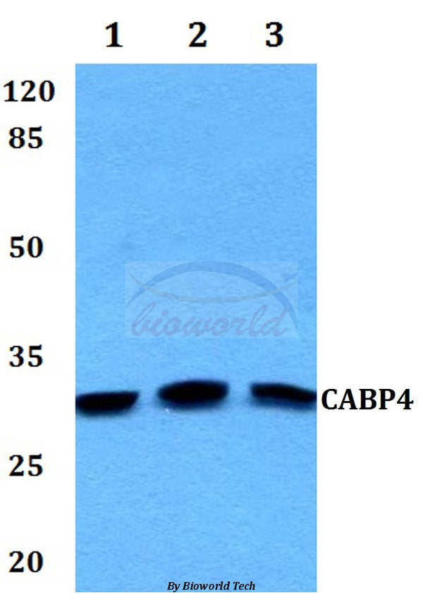 Western blot (WB) analysis of CABP4 polyclonal antibody at 1:500 dilution
Lane1:Hela whole cell lysate
Lane2:sp2/0 whole cell lysate
Lane3:PC12 whole cell lysate