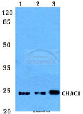Western blot (WB) analysis of CHAC1 polyclonal antibody at 1:500 dilution
Lane1:Hela whole cell lysate
Lane2:Raw264.7 whole cell lysate
Lane3:PC12 whole cell lysate